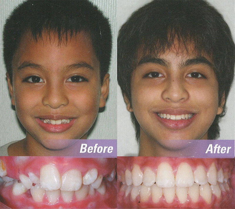 Orthodontics in Modesto, CA